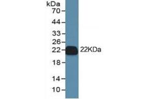 Rabbit Capture antibody from the kit in WB with Positive Control: Cell culture supernatant and CHO-S cell lysate which transfected with rat IL1b gene.