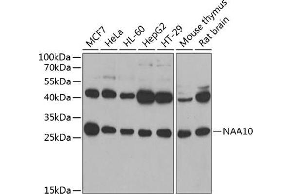 NAA10 antibody  (AA 161-235)