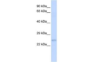 Image no. 1 for anti-Ras Homolog Gene Family, Member C (RHOC) (N-Term) antibody (ABIN2786344)