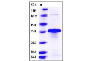 Image no. 1 for BCL2/adenovirus E1B 19kDa Interacting Protein 3-Like (BNIP3L) (AA 2-187) protein (ABIN2005245)