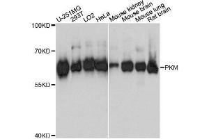 Image no. 1 for anti-Pyruvate Kinase M1/2 (PKM) antibody (ABIN6145714)