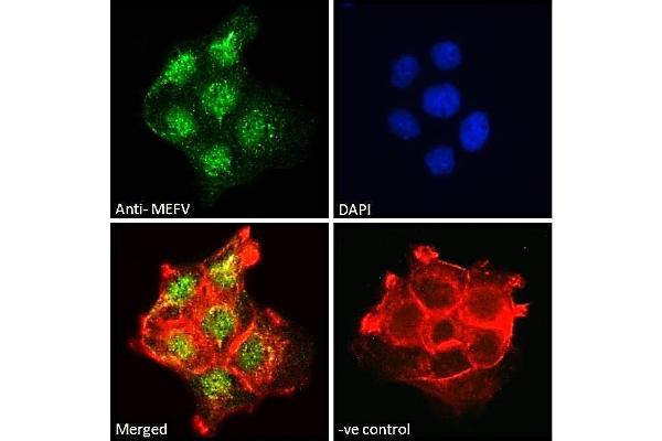 MEFV antibody  (Internal Region)