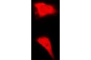 Image no. 1 for anti-CCCTC-Binding Factor (Zinc Finger Protein)-Like (CTCFL) (full length) antibody (ABIN6005280)