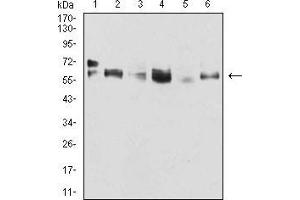 Image no. 5 for anti-Keratin 5 (KRT5) (AA 258-357) antibody (ABIN5542459)