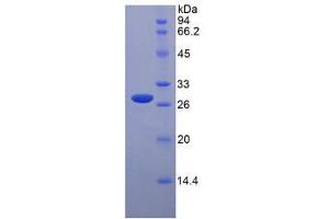 Image no. 1 for Tafazzin (TAZ) protein (ABIN3011799)