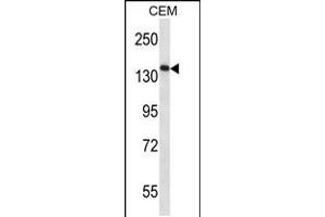 Image no. 2 for anti-Apoptosis-Associated tyrosine Kinase (AATK) (AA 46-74), (N-Term) antibody (ABIN5536368)