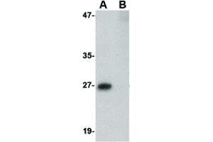 Image no. 1 for anti-phosphoribosyl Transferase Domain Containing 1 (PRTFDC1) (Internal Region) antibody (ABIN6657416)