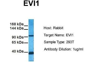 Host: Rabbit Target Name: EVI1 Sample Tissue: Human 293T Antibody Dilution: 1.