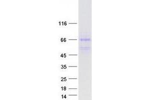 Image no. 1 for DnaJ (Hsp40) Homolog, Subfamily A, Member 3 (DNAJA3) (Transcript Variant 1) protein (Myc-DYKDDDDK Tag) (ABIN2719575)