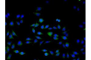 Image no. 7 for anti-Mitogen-Activated Protein Kinase 3 (MAPK3) (AA 101-200) antibody (ABIN736476)
