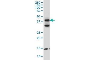 Image no. 1 for anti-Filamin Binding LIM Protein 1 (FBLIM1) (AA 270-373) antibody (ABIN565770)