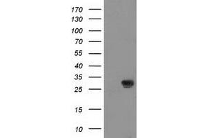 Image no. 3 for anti-Nicotinamide N-Methyltransferase (NNMT) antibody (ABIN1499790)