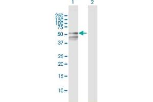 Image no. 1 for anti-RNA Binding Motif Protein, Y-Linked, Family 1, Member F (RBMY1F) (AA 1-496) antibody (ABIN949881)