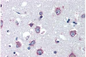 Image no. 2 for anti-Niemann-Pick Disease, Type C1 (NPC1) antibody (ABIN462125)
