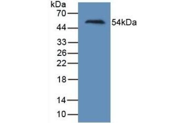 HAVCR1 Antikörper  (AA 21-240)