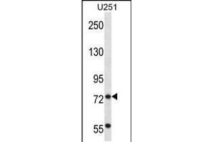 Image no. 1 for anti-Tripartite Motif Containing 2 (TRIM2) (AA 592-621), (C-Term) antibody (ABIN5537633)