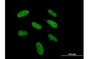 Image no. 1 for anti-DiGeorge Syndrome Critical Region Gene 6 (DGCR6) (AA 1-220) antibody (ABIN521805)