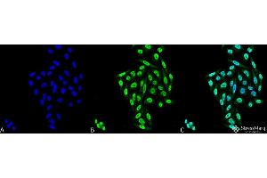 Image no. 1 for anti-Protein Phosphatase 5, Catalytic Subunit (PPP5C) antibody (FITC) (ABIN2868712)
