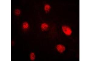 Immunofluorescent analysis of Pr-Set7 staining in MCF7 cells.