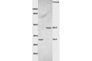 Image no. 2 for anti-Ceramide Synthase 2 (CERS2) (AA 201-300) antibody (ABIN709331)