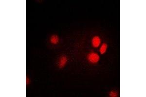 Image no. 1 for anti-Thymopoietin (TMPO) antibody (ABIN3198347)