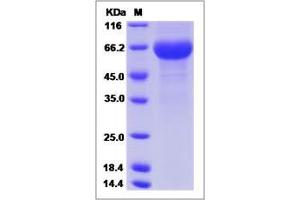 Image no. 1 for Pregnancy Specific beta-1-Glycoprotein 1 (PSG1) (AA 1-419) protein (His tag) (ABIN2006488)