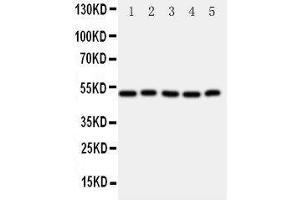 Image no. 2 for anti-Aldehyde Dehydrogenase 3 Family, Member A1 (ALDH3A1) (AA 440-453), (C-Term) antibody (ABIN3042917)