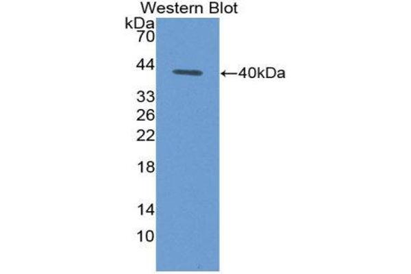 anti-Chemokine (C-C Motif) Ligand 4-Like 1 (CCL4L1) (AA 24-92) antibody