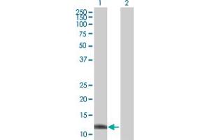 Image no. 1 for anti-Zinc Ribbon Domain Containing 1 (ZNRD1) (AA 1-126) antibody (ABIN526275)