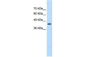 Image no. 1 for anti-Ureidopropionase, beta (UPB1) (Middle Region) antibody (ABIN629651)