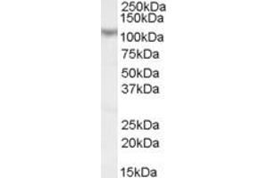 Image no. 2 for anti-Mastermind-Like 1 (MAML1) (N-Term) antibody (ABIN185074)