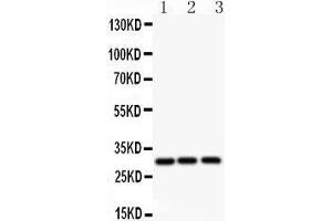 Image no. 3 for anti-Activating Transcription Factor 1 (AFT1) (AA 1-271) antibody (ABIN3043723)