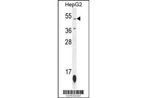 Image no. 1 for anti-Zinc Finger Protein 566 (ZNF566) (AA 110-138), (N-Term) antibody (ABIN654506)