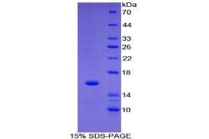 Image no. 2 for Fatty Acid Binding Protein 1, Liver (FABP1) ELISA Kit (ABIN6720499)