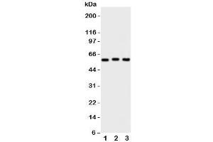 Western blot testing of PKM2 antibody and Lane 1:  HeLa;  2: MCF-7;  3: A549 cell lysate