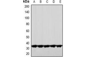 Image no. 2 for anti-CCR4-NOT Transcription Complex, Subunit 7 (CNOT7) (N-Term) antibody (ABIN3222863)