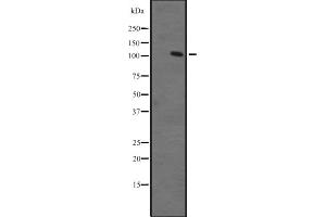 Image no. 1 for anti-Zinc Finger Protein, Multitype 1 (ZFPM1) (Internal Region) antibody (ABIN6257555)