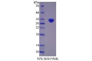Image no. 1 for Oviductal Glycoprotein 1 (OVGP1) (AA 231-476) protein (T7 tag,His tag) (ABIN6239193)