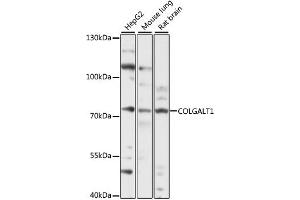 GLT25D1 抗体  (AA 30-230)