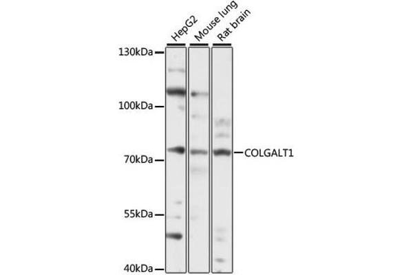 GLT25D1 抗体  (AA 30-230)