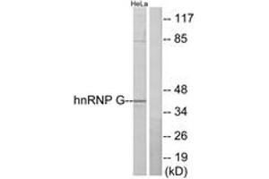 Image no. 2 for anti-RNA Binding Motif Protein, X-Linked (RBMX) (AA 6-55) antibody (ABIN1533719)