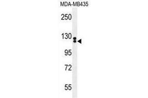 Image no. 2 for anti-Tubulin Tyrosine Ligase-Like Family, Member 13 (TTLL13) (AA 468-498), (Middle Region) antibody (ABIN955385)