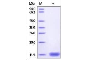Cynomolgus beta 2-Microglobulin, His Tag on SDS-PAGE under reducing (R) condition.