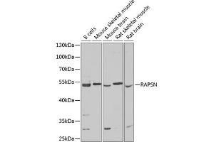 RAPSN anticorps  (AA 1-353)