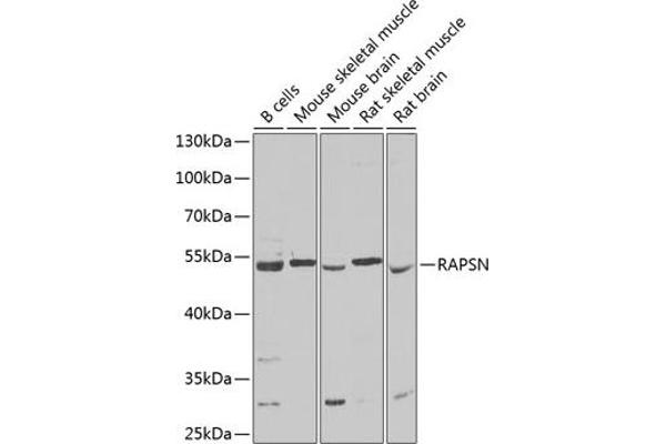 RAPSN anticorps  (AA 1-353)