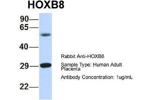 Image no. 1 for anti-Homeobox B8 (HOXB8) (N-Term) antibody (ABIN2781203)