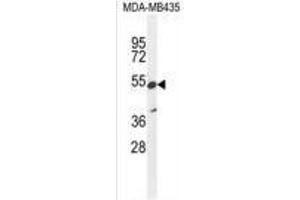 Image no. 2 for anti-Zinc Finger Protein 98 (ZNF98) (AA 486-516), (C-Term) antibody (ABIN955752)
