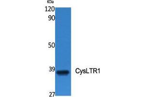 Image no. 2 for anti-Cysteinyl Leukotriene Receptor 1 (CYSLTR1) (Internal Region) antibody (ABIN3184208)