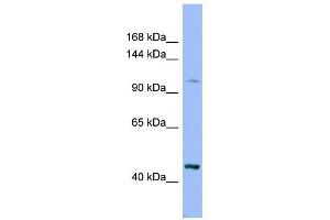 Image no. 1 for anti-Xylosyltransferase II (XYLT2) (Middle Region) antibody (ABIN635743)
