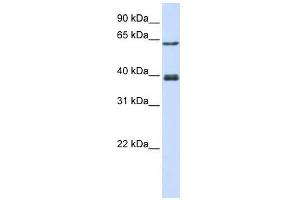 Image no. 1 for anti-IKAROS Family Zinc Finger 3 (Aiolos) (IKZF3) (C-Term) antibody (ABIN927759)